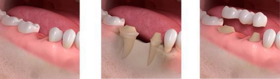 牙科诊所装修设计