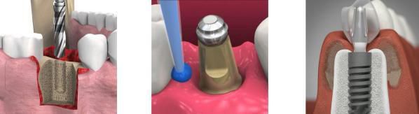 牙科诊所装修设计